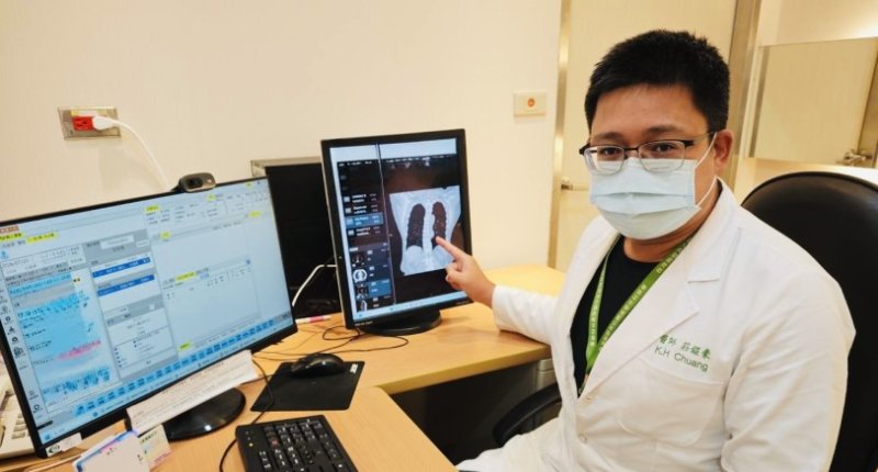 救心後再救肺！67歲婦歷經主動脈剝離  大同醫院3D/4K高階影像精準切除早期肺癌