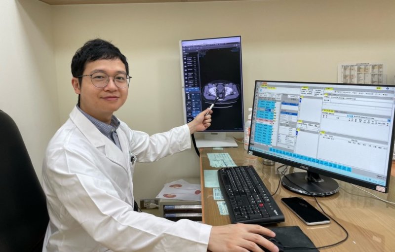 攝護腺極端肥大竟藏逾50顆膀胱結石  分階段清除結石　「三明治式」攝護腺手術助病人恢復順暢排尿