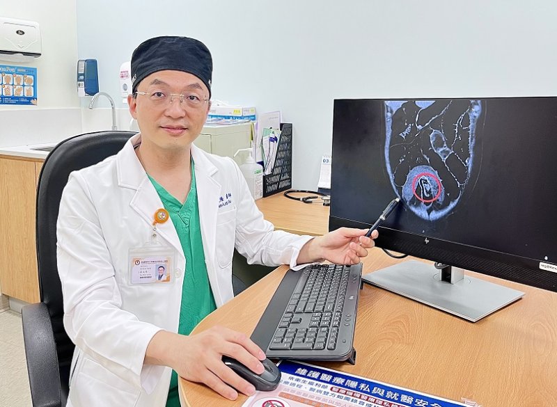 六旬男腹痛難耐 元凶竟是「整朵香菇」卡腸道 高醫岡山醫院手術成功取出異物 醫師提醒細嚼慢嚥防腸阻塞